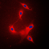 Immunofluorescent analysis of PPP2R1B staining in Raw264.7 cells. Formalin-fixed cells were permeabilized with 0.1% Triton X-100 in TBS for 5-10 minutes and blocked with 3% BSA-PBS for 30 minutes at room temperature. Cells were probed with the primary antibody in 3% BSA-PBS and incubated overnight at 4 C in a humidified chamber. Cells were washed with PBST and incubated with a DyLight 594-conjugated secondary antibody (red) in PBS at room temperature in the dark. DAPI was used to stain the cell nuclei (blue).