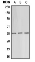 Western blot analysis of AMPK gamma 1 expression in HeLa (A); SP2/0 (B); H9C2 (C) whole cell lysates.