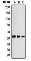 Western blot analysis of PRKAR2B expression in HeLa (A); SHSY5Y (B); NIH3T3 (C) whole cell lysates.