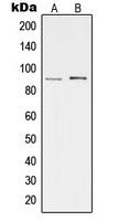Western blot analysis of cGK 2 expression in HeLa (A); Hs67 (B) whole cell lysates.