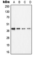 Western blot analysis of ECA39 expression in Jurkat (A); Ramos (B); NIH3T3 (C); PC12 (D) whole cell lysates.