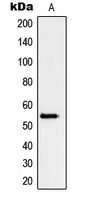 Western blot analysis of Peripherin expression in HeLa (A) whole cell lysates.