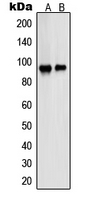 Western blot analysis of PSMD2 expression in A431 (A); HeLa (B) whole cell lysates.