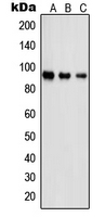Western blot analysis of PSMD2 expression in Jurkat (A); A431 (B); NIH3T3 (C) whole cell lysates.