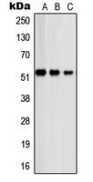 Western blot analysis of PSMD12 expression in A431 (A); COLO320 (B); HeLa (C) whole cell lysates.