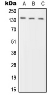 Western blot analysis of Phogrin expression in HeLa (A); SP2/0 (B); H9C2 (C) whole cell lysates.