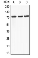 Western blot analysis of ABCD4 expression in Jurkat (A); Raji (B); THP1 (C) whole cell lysates.