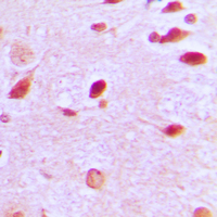Immunohistochemical analysis of RAP1GAP staining in human brain formalin fixed paraffin embedded tissue section. The section was pre-treated using heat mediated antigen retrieval with sodium citrate buffer (pH 6.0). The section was then incubated with the antibody at room temperature and detected using an HRP conjugated compact polymer system. DAB was used as the chromogen. The section was then counterstained with haematoxylin and mounted with DPX.