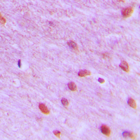 Immunohistochemical analysis of RFC3 staining in human brain formalin fixed paraffin embedded tissue section. The section was pre-treated using heat mediated antigen retrieval with sodium citrate buffer (pH 6.0). The section was then incubated with the antibody at room temperature and detected using an HRP conjugated compact polymer system. DAB was used as the chromogen. The section was then counterstained with haematoxylin and mounted with DPX.