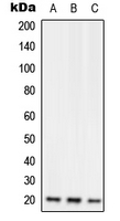 Western blot analysis of RGS10 expression in Jurkat (A); Raw264.7 (B); H9C2 (C) whole cell lysates.