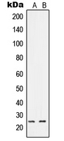 Western blot analysis of RIT1 expression in A549 (A); HeLa (B) whole cell lysates.