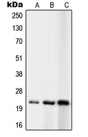 Western blot analysis of RPL10 expression in K562 (A); MCF7 (B); Ramos (C) whole cell lysates.
