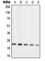 Western blot analysis of RPL10 expression in MCF7 (A); Jurkat (B); K562 (C); Raw264.7 (D); PC12 (E) whole cell lysates.