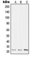 Western blot analysis of RPL17 expression in A375 (A); Raw264.7 (B); H9C2 (C) whole cell lysates.