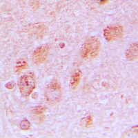 Immunohistochemical analysis of RPL17 staining in human brain formalin fixed paraffin embedded tissue section. The section was pre-treated using heat mediated antigen retrieval with sodium citrate buffer (pH 6.0). The section was then incubated with the antibody at room temperature and detected using an HRP conjugated compact polymer system. DAB was used as the chromogen. The section was then counterstained with haematoxylin and mounted with DPX.