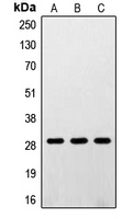 Western blot analysis of RPS4Y1 expression in A431 (A); K562 (B); HEK293 (C) whole cell lysates.