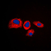 Immunofluorescent analysis of RPS4Y1 staining in K562 cells. Formalin-fixed cells were permeabilized with 0.1% Triton X-100 in TBS for 5-10 minutes and blocked with 3% BSA-PBS for 30 minutes at room temperature. Cells were probed with the primary antibody in 3% BSA-PBS and incubated overnight at 4 C in a humidified chamber. Cells were washed with PBST and incubated with a DyLight 594-conjugated secondary antibody (red) in PBS at room temperature in the dark. DAPI was used to stain the cell nuclei (blue).