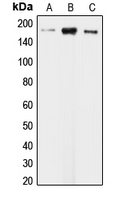 Western blot analysis of CLIP1 expression in KNRK (A); HeLa (B); HepG2 (C) whole cell lysates.