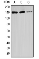 Western blot analysis of Ataxin 2 expression in HeLa (A); U87MG (B); Jurkat (C) whole cell lysates.