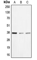 Western blot analysis of BNIP2 expression in HEK293T (A); mouse liver (B); rat liver (C) whole cell lysates.
