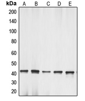 Western blot analysis of Gamma-actin-1 expression in HeLa (A); Raw264.7 (B); PC12 (C); L929 (D); C6 (E) whole cell lysates.