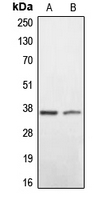 Western blot analysis of BNIP2 expression in HEK293T (A); mouse liver (B) whole cell lysates.