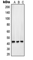 Western blot analysis of Surfactant Protein B expression in HepG2 (A); Y79 (B); A549 (C) whole cell lysates.