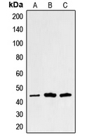 Western blot analysis of Alpha-sarcoglycan expression in HuvEc (A); Raw264.7 (B); PC12 (C) whole cell lysates.