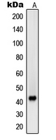 Western blot analysis of Beta-sarcoglycan expression in MCF7 (A) whole cell lysates.