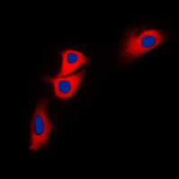 Immunofluorescent analysis of BNIP2 staining in HEK293T cells. Formalin-fixed cells were permeabilized with 0.1% Triton X-100 in TBS for 5-10 minutes and blocked with 3% BSA-PBS for 30 minutes at room temperature. Cells were probed with the primary antibody in 3% BSA-PBS and incubated overnight at 4 C in a humidified chamber. Cells were washed with PBST and incubated with a DyLight 594-conjugated secondary antibody (red) in PBS at room temperature in the dark. DAPI was used to stain the cell nuclei (blue).
