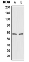 Western blot analysis of GLUT2 expression in HEK293T (A); rat kidney (B) whole cell lysates.