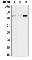Western blot analysis of SGLT2 expression in HeLa (A); SP2/0 (B); H9C2 (C) whole cell lysates.