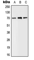 Western blot analysis of SLC6A8 expression in MDAMB435 (A); Raw264.7 (B); H9C2 (C) whole cell lysates.