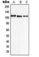 Western blot analysis of NCX1 expression in K562 (A); A549 (B); HL60 (C) whole cell lysates.