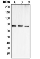 Western blot analysis of OATP1 expression in Jurkat (A); MCF7 (B); SHSY5Y (C) whole cell lysates.
