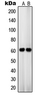 Western blot analysis of OCT3 expression in HT29 (A); JAR (B) whole cell lysates.