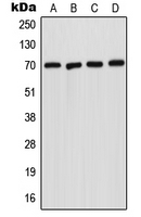Western blot analysis of Acid Sphingomyelinase expression in A431 (A); HepG2 (B); SP2/0 (C); H9C2 (D) whole cell lysates.