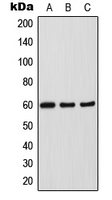 Western blot analysis of SOX11 expression in HepG2 (A); HeLa (B); SP2/0 (C) whole cell lysates.
