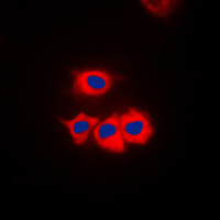 Immunofluorescent analysis of SSBP1 staining in HeLa cells. Formalin-fixed cells were permeabilized with 0.1% Triton X-100 in TBS for 5-10 minutes and blocked with 3% BSA-PBS for 30 minutes at room temperature. Cells were probed with the primary antibody in 3% BSA-PBS and incubated overnight at 4 C in a humidified chamber. Cells were washed with PBST and incubated with a DyLight 594-conjugated secondary antibody (red) in PBS at room temperature in the dark. DAPI was used to stain the cell nuclei (blue).