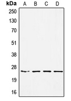 Western blot analysis of SSX-pan expression in HEK293 (A); MDAMB453 (B); SW480 (C); A549 (D) whole cell lysates.