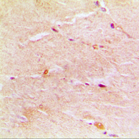Immunohistochemical analysis of Gamma-actin-1 staining in human muscle formalin fixed paraffin embedded tissue section. The section was pre-treated using heat mediated antigen retrieval with sodium citrate buffer (pH 6.0). The section was then incubated with the antibody at room temperature and detected using an HRP conjugated compact polymer system. DAB was used as the chromogen. The section was then counterstained with haematoxylin and mounted with DPX.