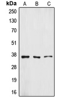 Western blot analysis of ZFP36L1 expression in A431 (A); HuvEc (B); A549 (C) whole cell lysates.
