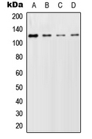Western blot analysis of GCFC2 expression in HeLa (A); SP2/0 (B); PC12 (C) whole cell lysates.