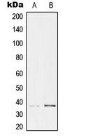 Western blot analysis of TCF19 expression in HeLa (A); HEK293 (B) whole cell lysates.