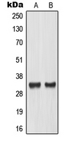 Western blot analysis of TCFL4 expression in LOVO (A); mouse placenta (B) whole cell lysates.