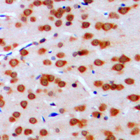 Immunohistochemical analysis of TCFL4 staining in human brain formalin fixed paraffin embedded tissue section. The section was pre-treated using heat mediated antigen retrieval with sodium citrate buffer (pH 6.0). The section was then incubated with the antibody at room temperature and detected using an HRP conjugated compact polymer system. DAB was used as the chromogen. The section was then counterstained with haematoxylin and mounted with DPX.