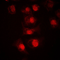 Immunofluorescent analysis of TCFL4 staining in LOVO cells. Formalin-fixed cells were permeabilized with 0.1% Triton X-100 in TBS for 5-10 minutes and blocked with 3% BSA-PBS for 30 minutes at room temperature. Cells were probed with the primary antibody in 3% BSA-PBS and incubated overnight at 4 C in a humidified chamber. Cells were washed with PBST and incubated with a DyLight 594-conjugated secondary antibody (red) in PBS at room temperature in the dark. DAPI was used to stain the cell nuclei (blue).
