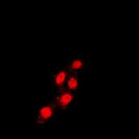 Immunofluorescent analysis of TEAD1 staining in Raw264.7 cells. Formalin-fixed cells were permeabilized with 0.1% Triton X-100 in TBS for 5-10 minutes and blocked with 3% BSA-PBS for 30 minutes at room temperature. Cells were probed with the primary antibody in 3% BSA-PBS and incubated overnight at 4 C in a humidified chamber. Cells were washed with PBST and incubated with a DyLight 594-conjugated secondary antibody (red) in PBS at room temperature in the dark. DAPI was used to stain the cell nuclei (blue).