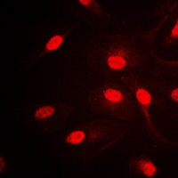 Immunofluorescent analysis of AP2 alpha/beta staining in HepG2 cells. Formalin-fixed cells were permeabilized with 0.1% Triton X-100 in TBS for 5-10 minutes and blocked with 3% BSA-PBS for 30 minutes at room temperature. Cells were probed with the primary antibody in 3% BSA-PBS and incubated overnight at 4 C in a humidified chamber. Cells were washed with PBST and incubated with a DyLight 594-conjugated secondary antibody (red) in PBS at room temperature in the dark. DAPI was used to stain the cell nuclei (blue).