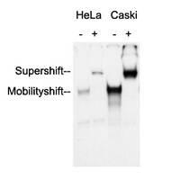 Anti-AP2 alpha/beta Antibody was used in an Electrophoretic Mobility Shift Assay (EMSA) to supershift the protein-DNA complex. Radiolabelled double-stranded DNA oligonucleotides (10.000 cpm per lane) harbouring a binding site for AP2 alpha/beta were incubated with each 2 ug of nuclear extract (NE) from HeLa and Caski cells respectively. Samples were incubated for 30 minutes at room temperature to allow the formation of protein-DNA complexes. Anti-AP2 alpha/beta Antibody were added to the samples (as indicated) and incubated for further 60 minutes at 4 C. Samples were separated in a 5.5% PAGE. The Gel was dried under vacuum and for autoradiography a X-ray film was exposed with an intensifying screen for 2 days at -80 C. Specific protein-DNA complexes were quantitatively supershifted with Anti-AP2 alpha/beta Antibody verifying the binding of AP2 alpha/beta to the DNA oligonucleotide.